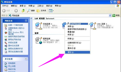 网络连接 网络连接