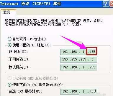 本地连接 本地连接